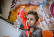 Young boy holds up a water bottle with his new prosthetic arm